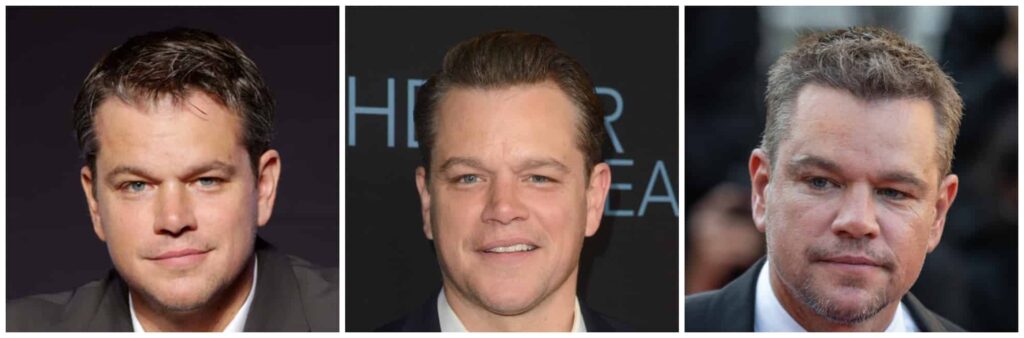 Matt Damon's hairline