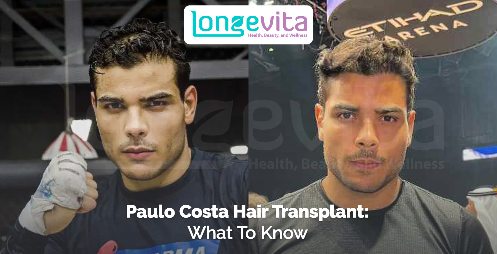 side-by-side images of Paulo Costa with headline about hair transplant speculation