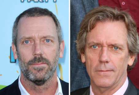 Hugh Laurie's hair before and after