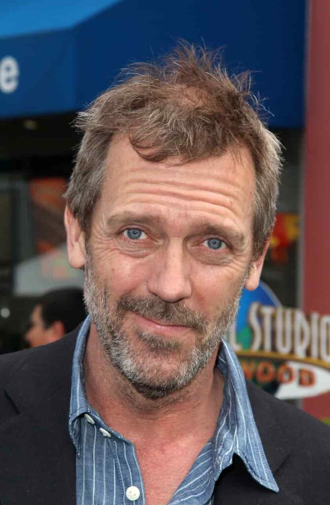 Hugh Laurie's hair loss in 2011