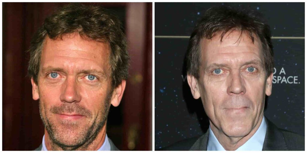 Hugh Laurie's old vs new hair