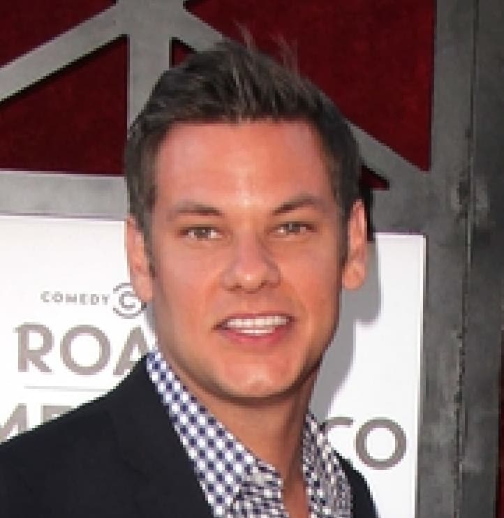 Theo Von Hair Transplant Longevita