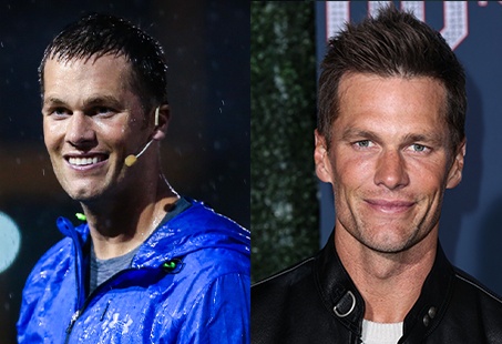 Tom Brady's hair before and after