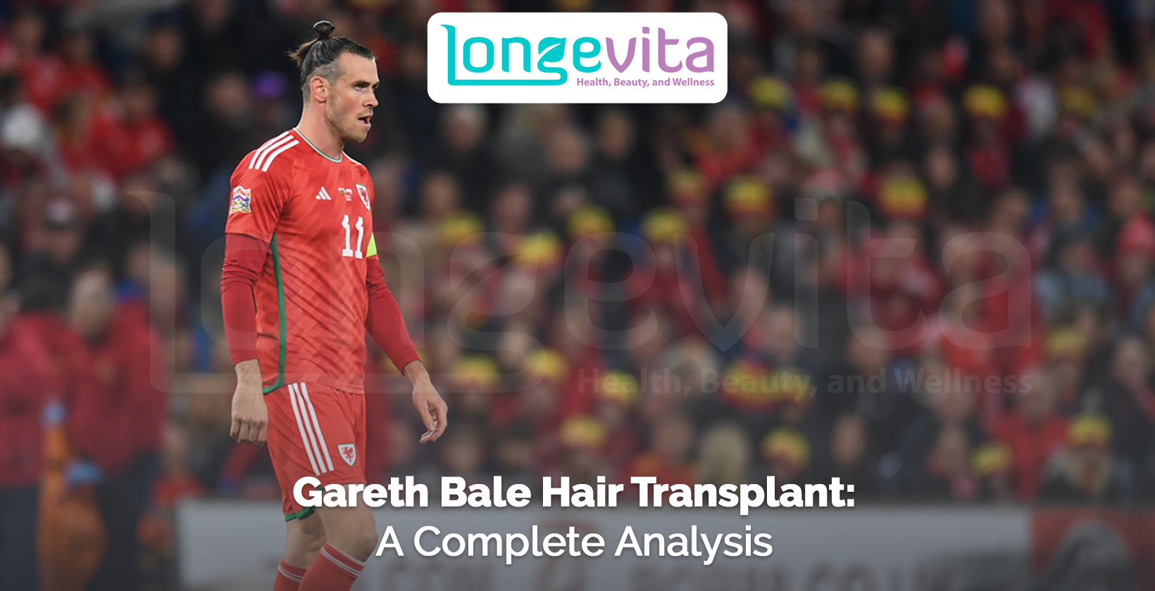 Gareth Bale in football kit on the field with headline about hair transplant analysis