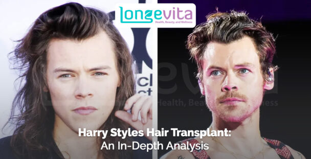 side-by-side images of Harry Styles with long and short hairstyles with headline about hair transplant