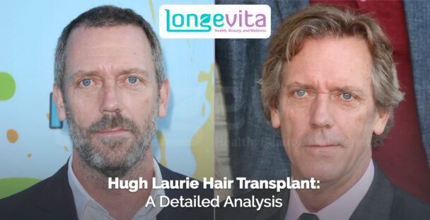 side-by-side images of Hugh Laurie with different hairstyles and headline about hair transplant