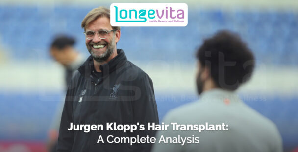 Jurgen Klopp smiling on football field with headline about hair transplant analysis