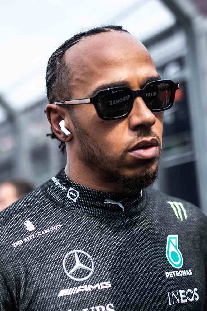 lewis hamilton hairtransplant