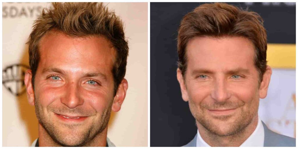 Bradley Coopers hair before and after