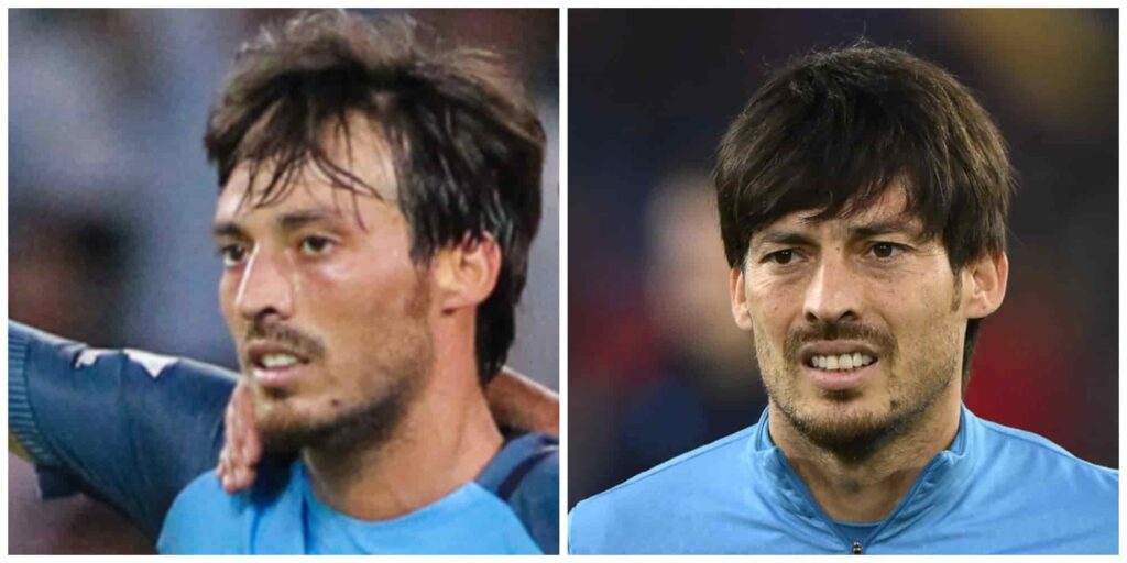 David Silvas hair before and after