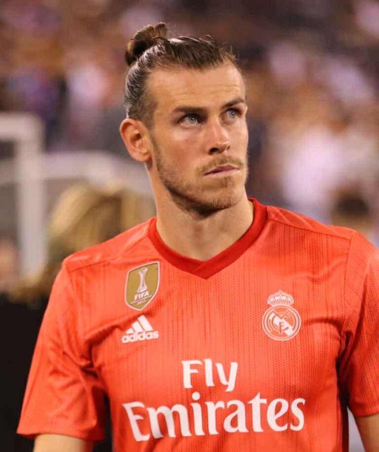 Gareth Bale's Hair Transplant Longevita