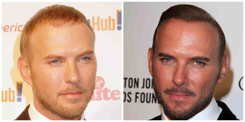 Matt Goss hair before and after