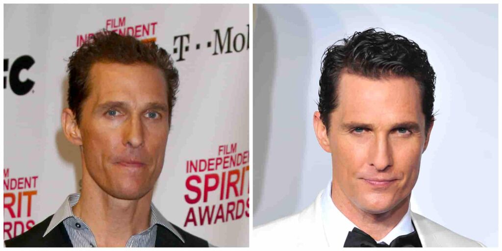 Matthew McConaughey's second alleged hair transplant