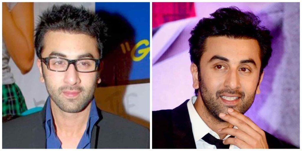 Ranbir Kapoors hair before and after