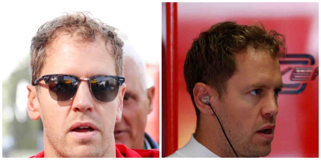 Sebastian Vettels hair in 2019 and 2020