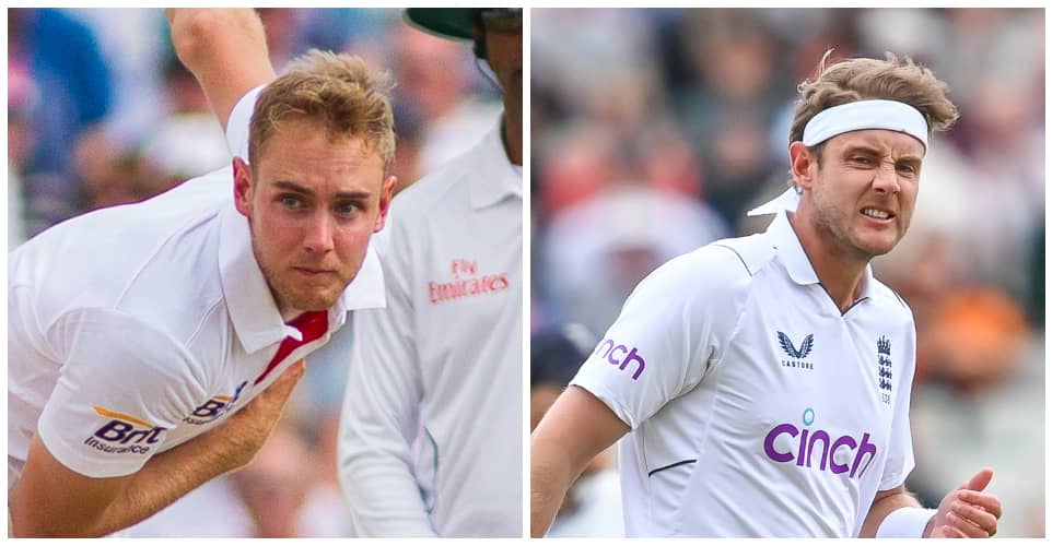 Stuart Broad before and after alleged hair transplants