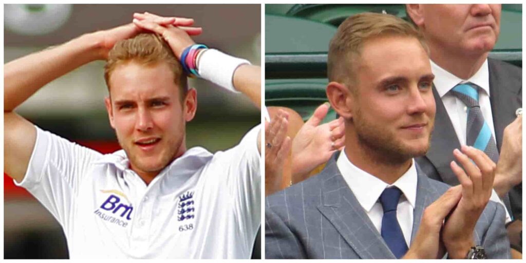Stuart Broad hair before and after