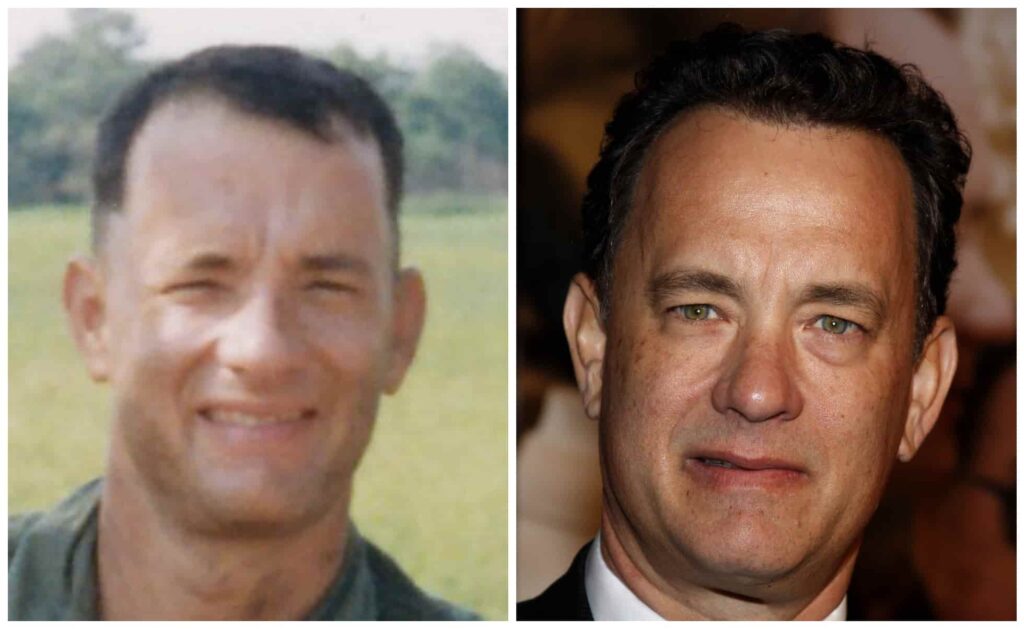 Tom Hanks rumoured hair transplant