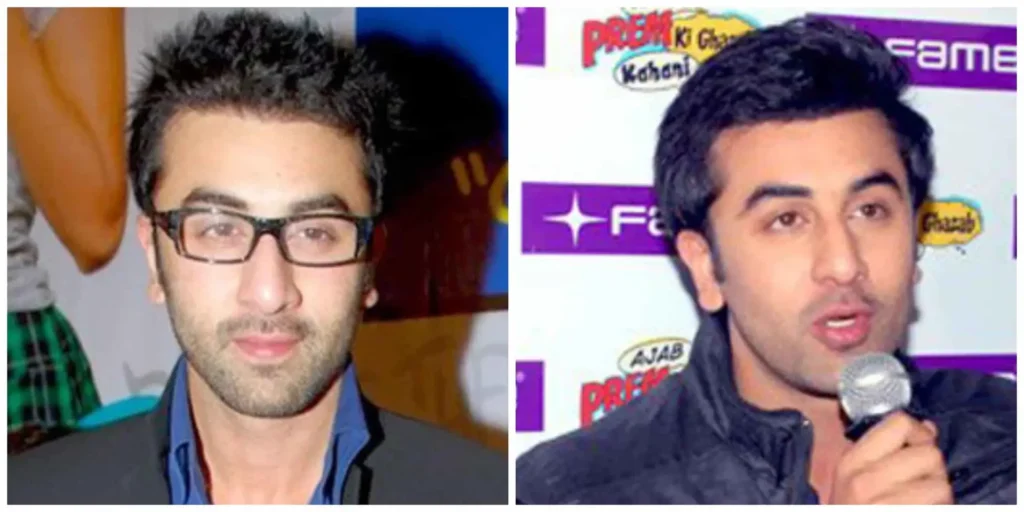 Ranbir Kapoor wig allegations