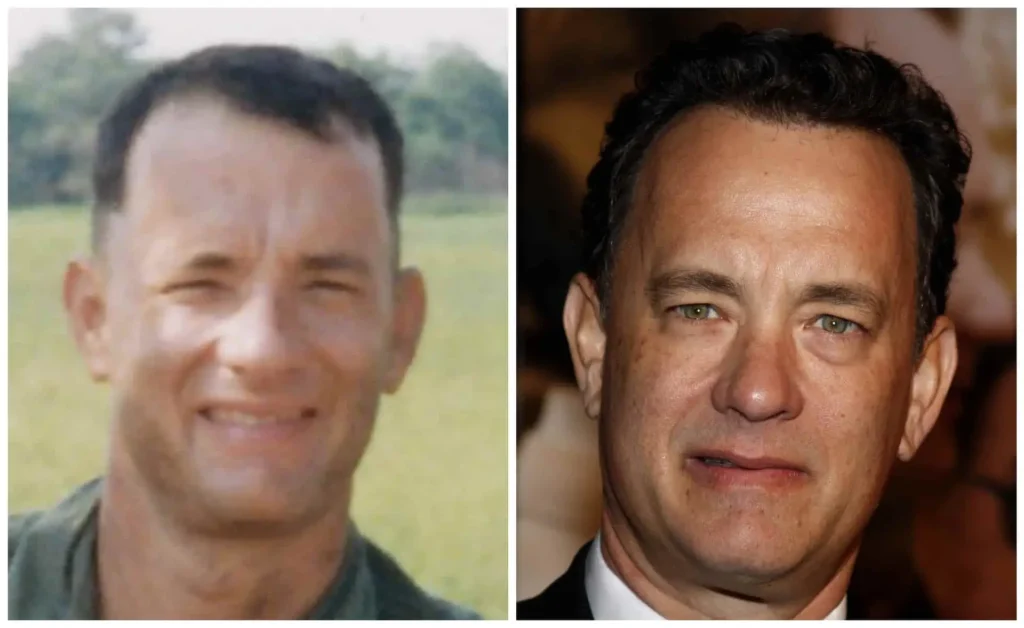 Tom Hanks rumoured hair transplant
