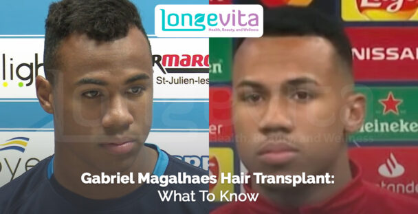 side-by-side images of Gabriel Magalhaes with different hairstyles and headline about hair transplant