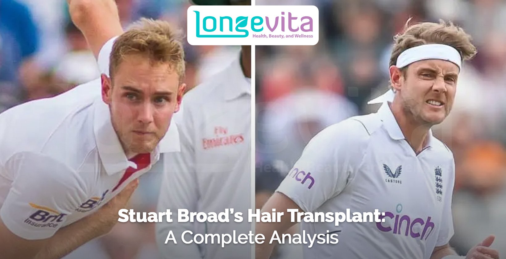 side-by-side images of Stuart Broad playing cricket with headline about hair transplant analysis