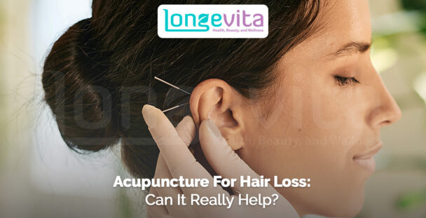 woman receiving acupuncture near the scalp for hair loss treatment