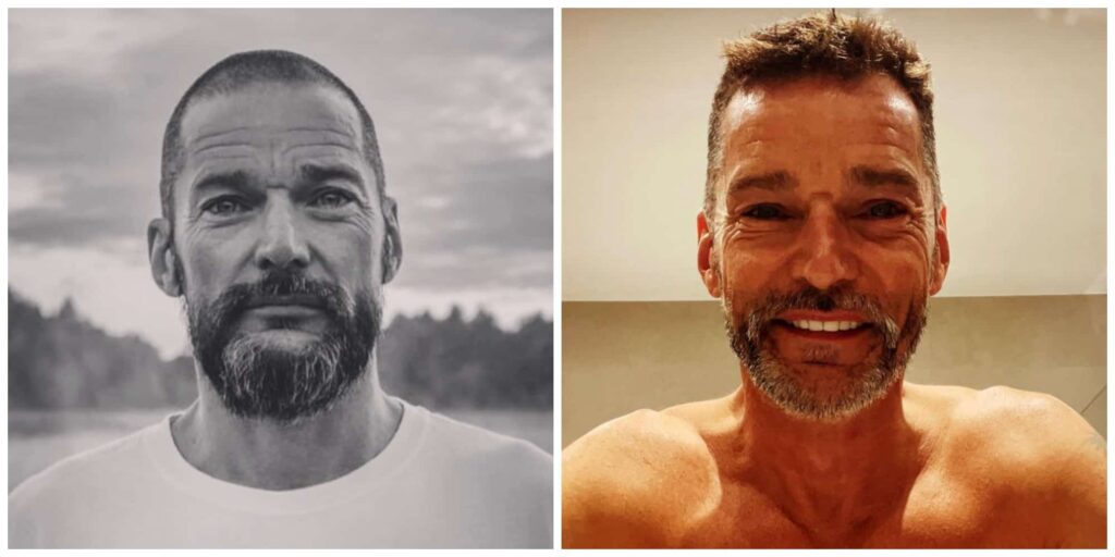 Fred Sirieix hair before and after