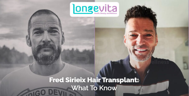 side-by-side photos of Fred Sirieix showing hair changes with headline about transplant information