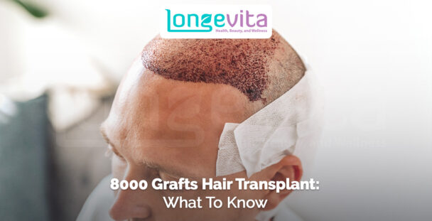 close-up of man's scalp after receiving 8000 grafts in a hair transplant