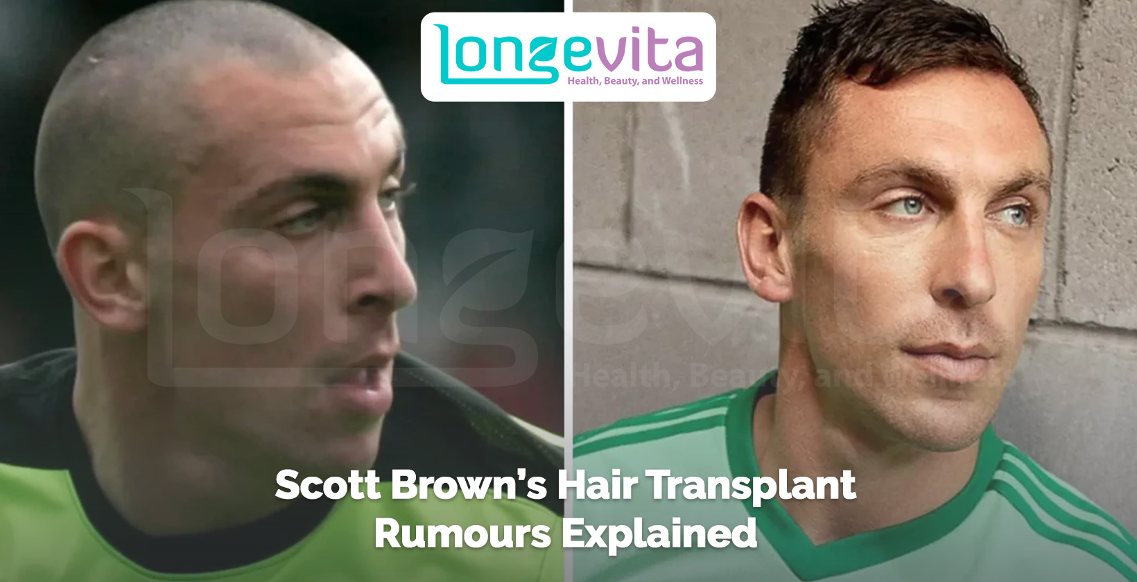 side-by-side images of Scott Brown before and after hair changes with headline about transplant rumours