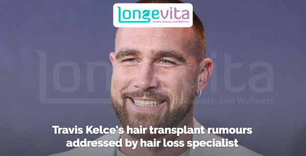 close-up of smiling man with short hair and beard with headline about hair transplant rumours
