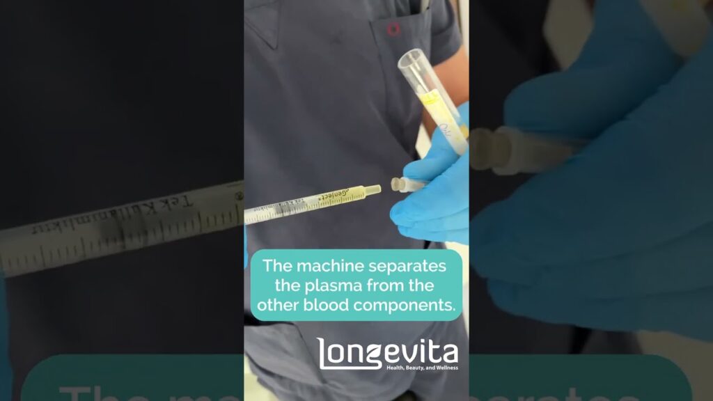Video Thumbnail: How is PRP performed? | Quick and Effective | Longevita