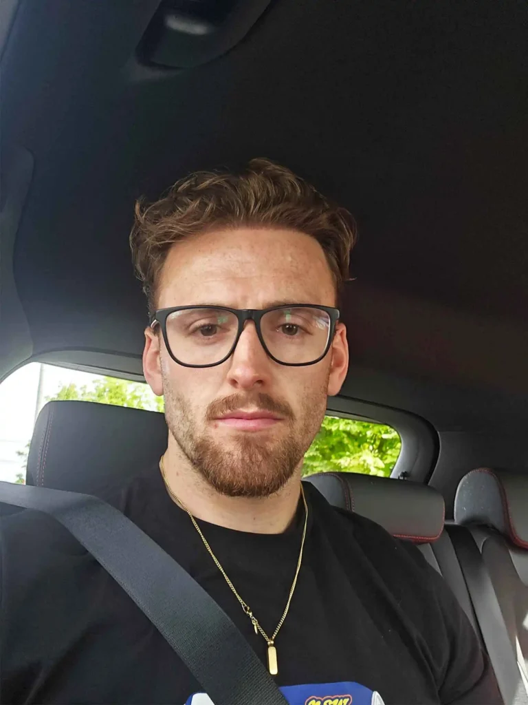 after photo 1 (2 year post op)