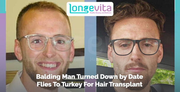 Before-and-after images of a man with glasses, headline about travelling to Turkey for a hair transplant