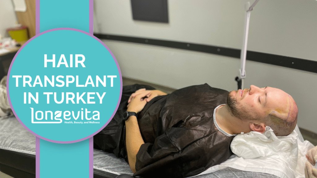 bald man lying on a medical bed during hair transplant procedure in Turkey