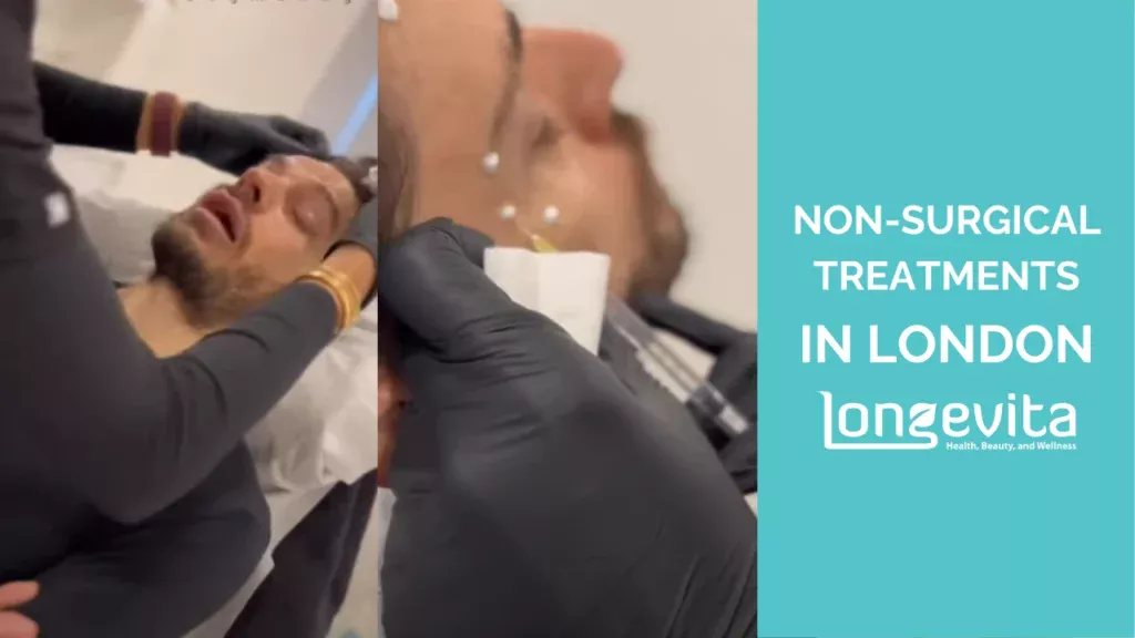 before and after images showing treatment results of Dr Gizem’s patients at Longevita London clinic