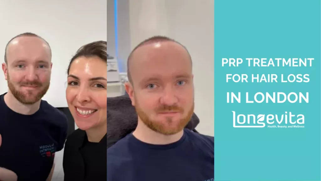 man with receding hairline before and after PRP hair loss treatment in London with female practitioner