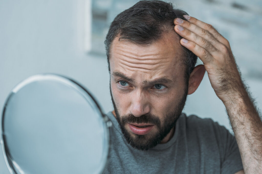 man examining thinning hair in the mirror with a concerned expression